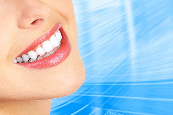 Learn More About the Process of Getting Dental Veneers
