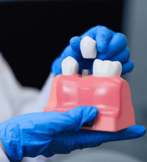 dental-implant-img