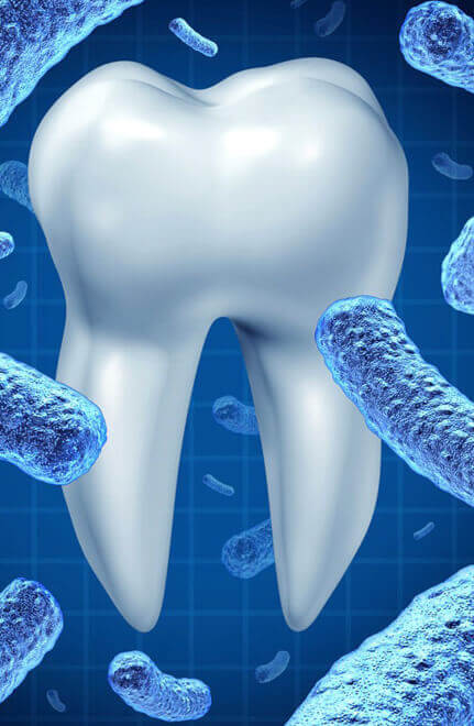 img-Are-There-Any-Risks-Associated-With-Six-Month-Smiles