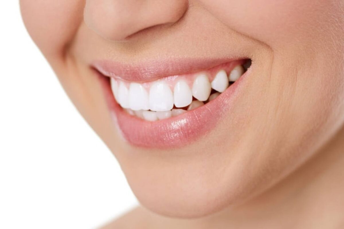 Beaming Brilliance: Unveiling The Magic Of Laser Teeth Whitening