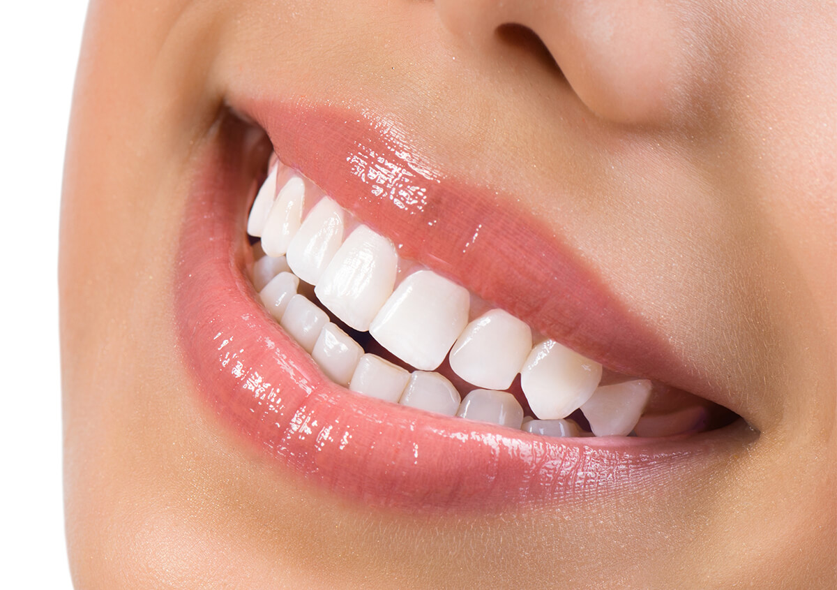 From Imperfections to Perfection: How Porcelain And Non-Invasive Veneers Can Transform Your Smile