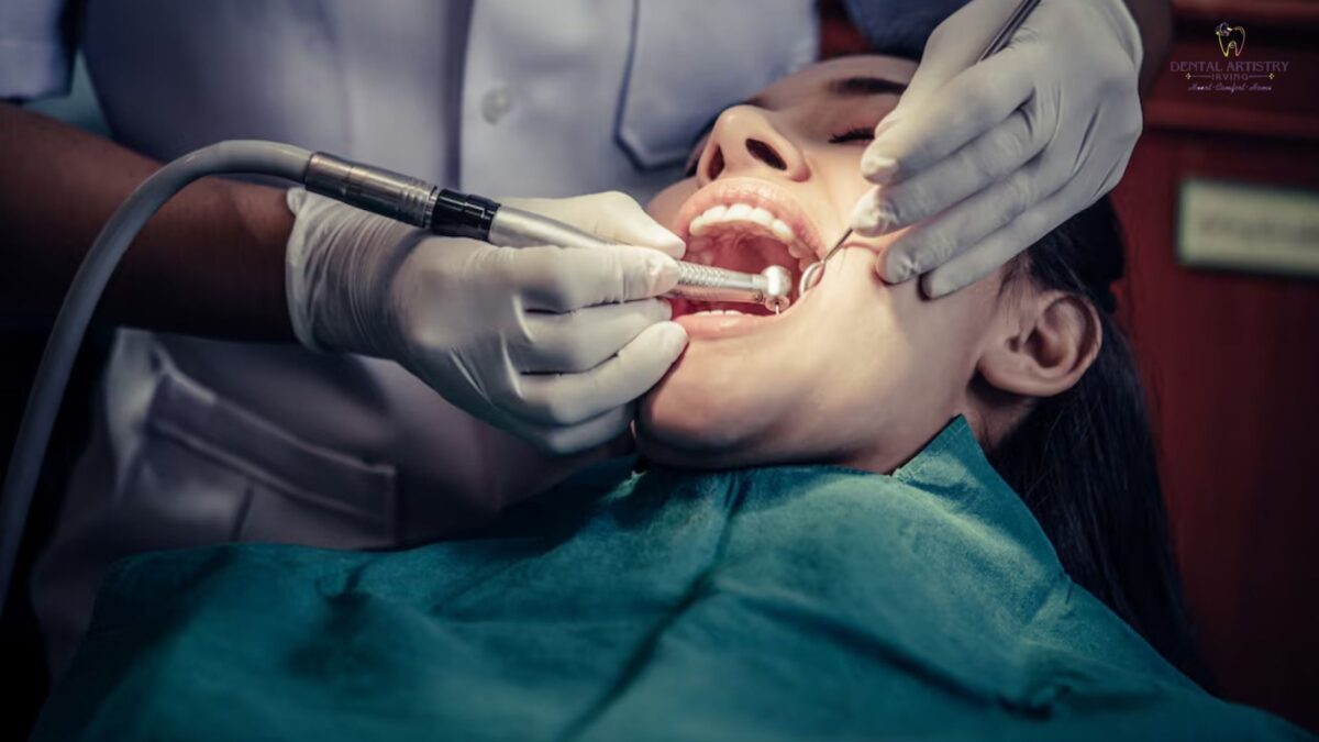 tooth-extraction-Irving