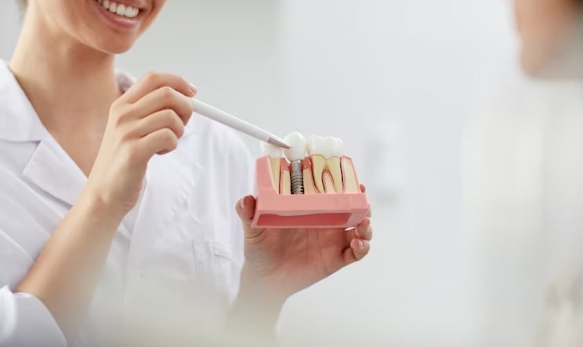 Embarking on the Journey of Dental Implants