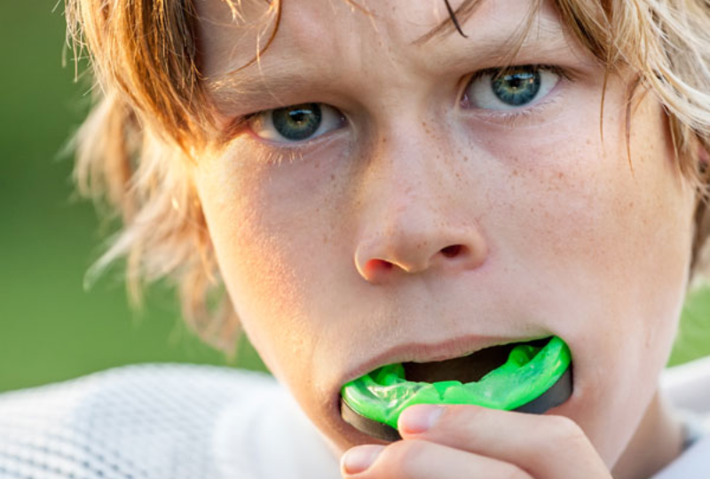 Mouth Guards and Concussion Prevention - Exploring the Connection
