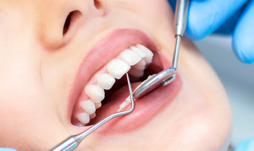 Full Mouth Reconstruction: Your Pathway to Dental Wellness