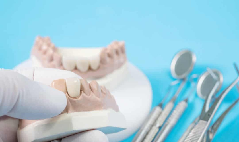 Same-Day Crowns: Modern Dental Solutions for Damaged Teeth