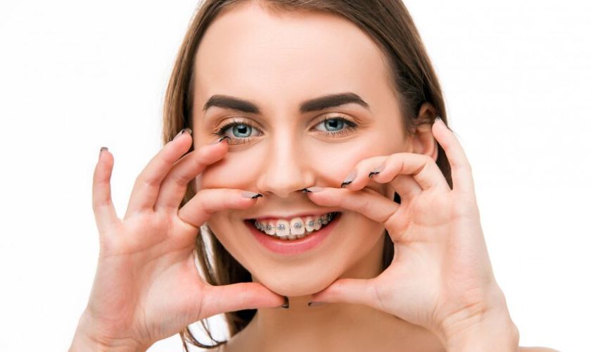 How to Care for Your Teeth with Braces: Essential Tips and Tricks