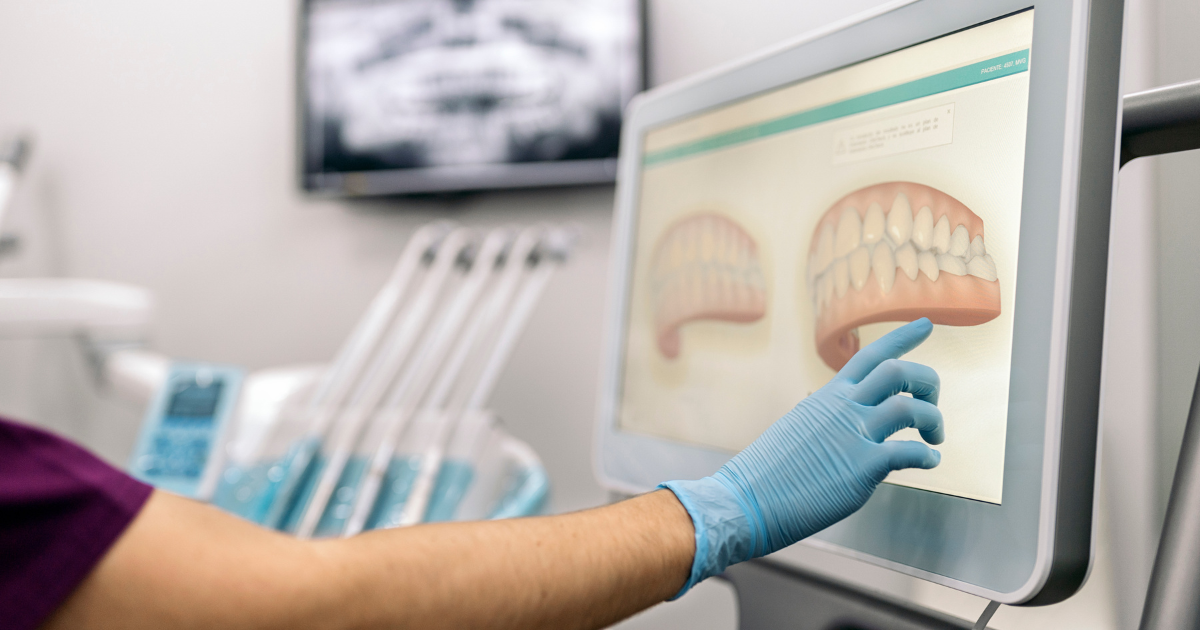 A Step-by-Step Guide to Digital Smile Design: What to Expect During Your Consultation