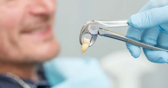 Wisdom Teeth Extraction and Pain Management: How to Handle the First 48 Hours