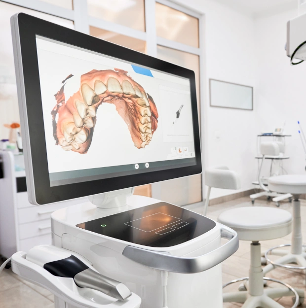 CEREC dental design software displayed on a desktop monitor